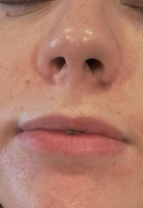 Before