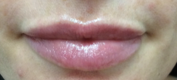 After