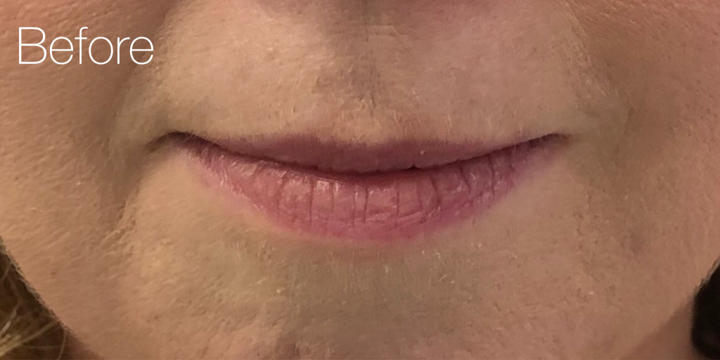 Before