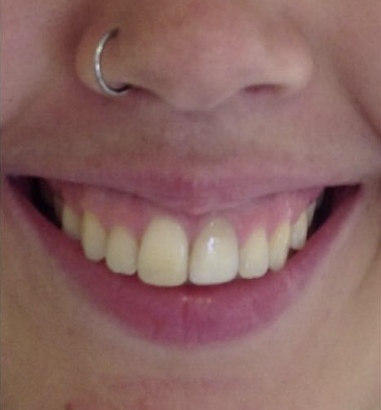 Before