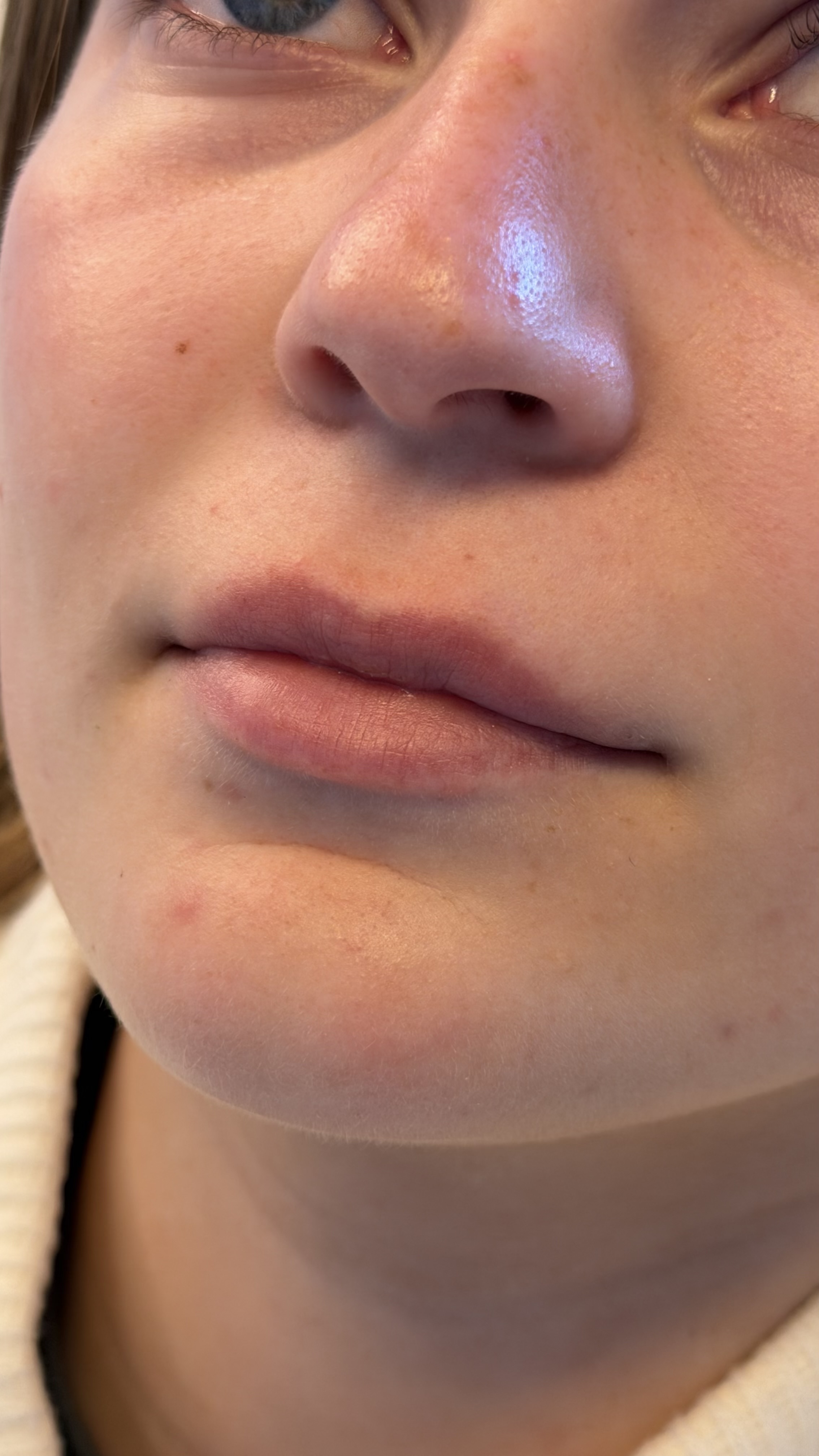 Before