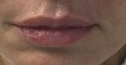 After