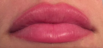 After