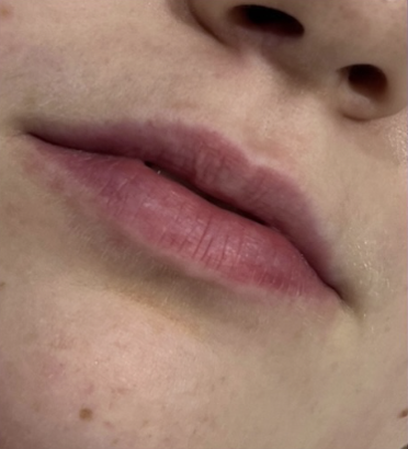 Before