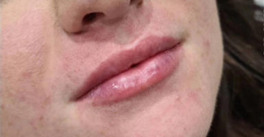 After