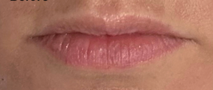Before