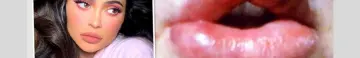 Times Botched lips.png