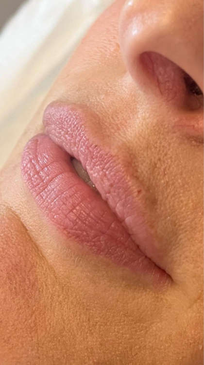 after lips x1.png