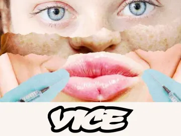 VICE 22.png