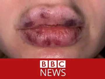 bbc lips went black.png