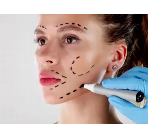 PDO Thread Lifts vs. Surgical Facelifts: Managing Expectations and Safety