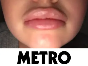 Metro lips.png