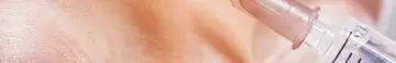 what to expect botox.png