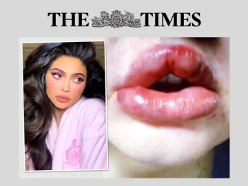 Times Botched lips.png