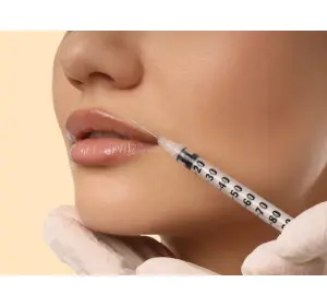 Lip Filler: How Much Is Too Much?