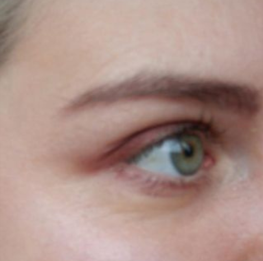 after crows feet.png