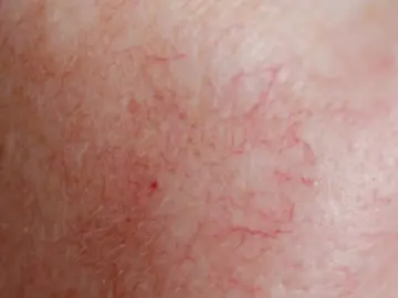 New Website Blog Images (25).png