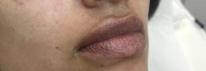 after lips.png