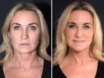 New Website Blog Images (445 × 333 px) (890 × 666 px) (6).png