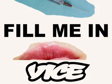 VICE.png