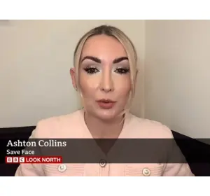 BBC: Botulism fears over botox-linked cases in Leeds