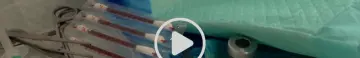 5 news bleph.png