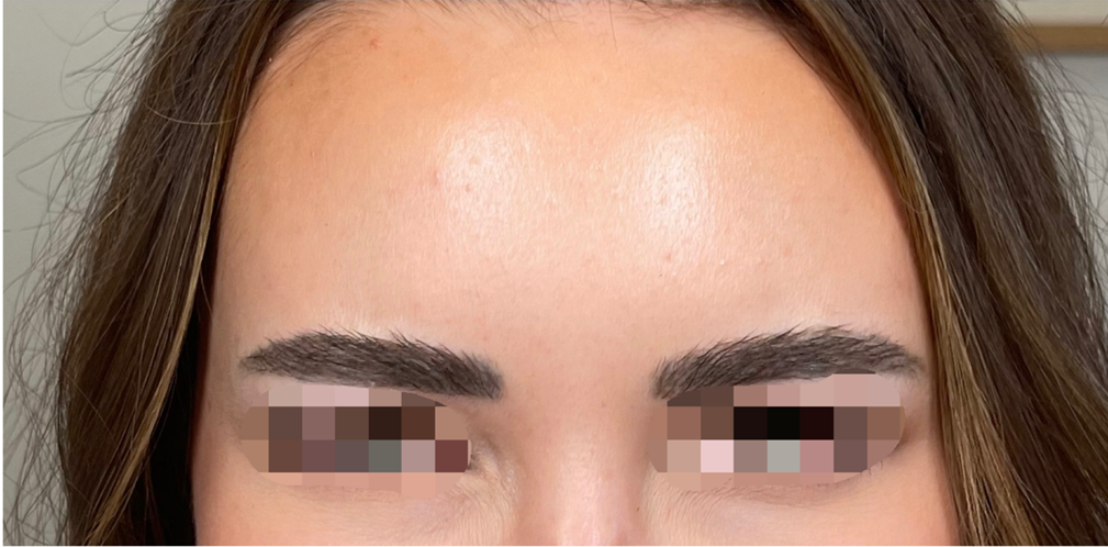 anti wrinkle- after.186365ed237e804d7aea6fb44f2f8321c96604aaa6e42ef92767fbdb8a2fc0fa.png