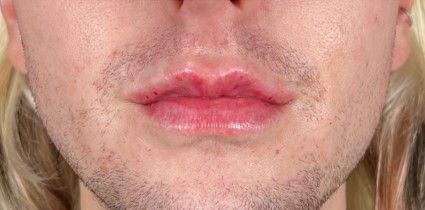 male after lips.jpg