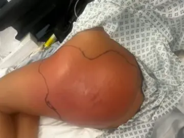 BBL Campaign newsletter.png