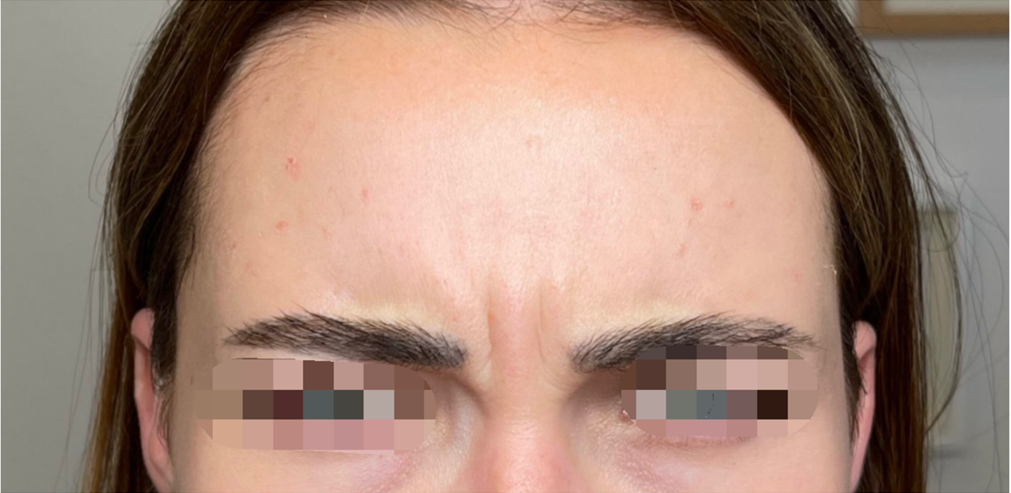 anti wrinkle - before.14757f530cc34a66dede84a6c175929a2a0a7316dee1eaf0a67b5dfe62e437e0.png