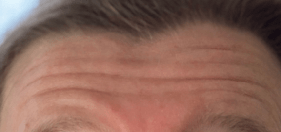 Anti Wrinkle 1.png