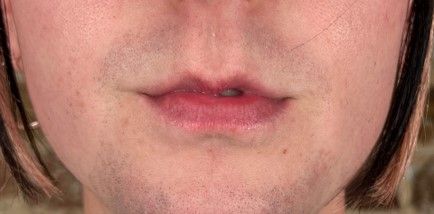 male before lips.jpg